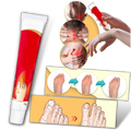 Creme anti-inflamatória Aomeily para o tratamento de joanetes e dores nos pés, aplicada na região dos dedos dos pés.