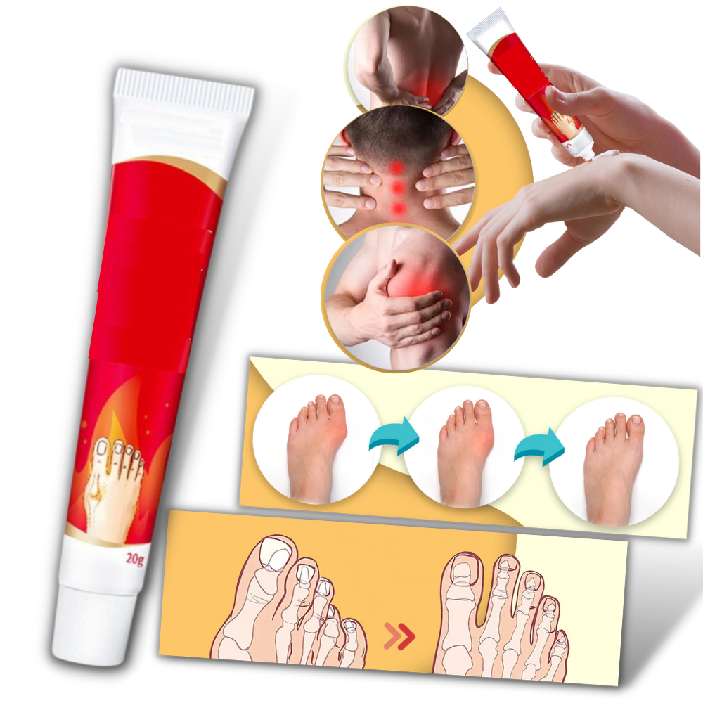Creme anti-inflamatória Aomeily para o tratamento de joanetes e dores nos pés, aplicada na região dos dedos dos pés.