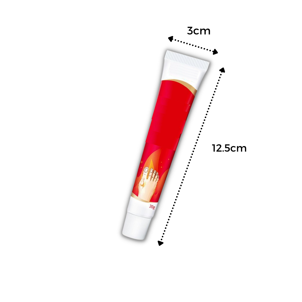 Creme anti-inflamatória para o tratamento de joanetes nos pés, produto da marca Aomeily, aplicada na região do dedo do pé.