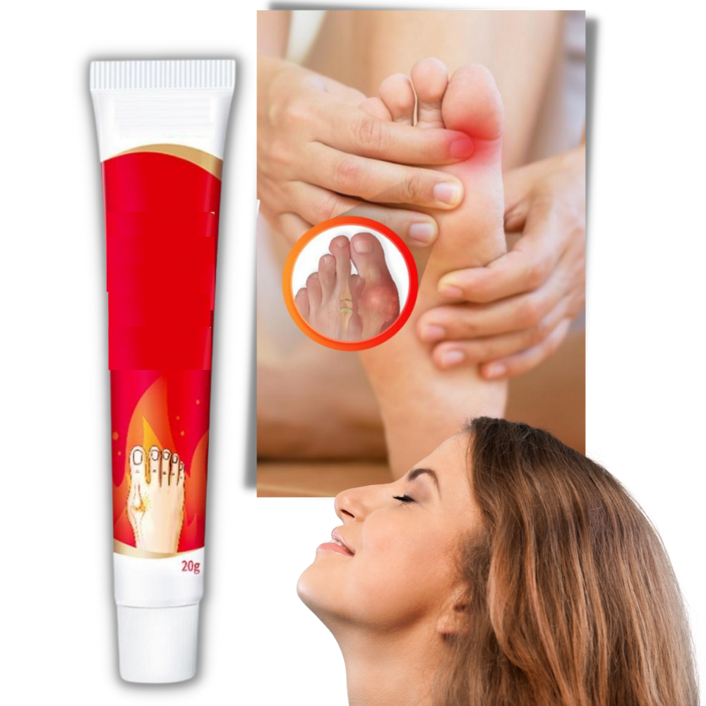 Creme anti-inflamatória Aomeily para oignons do pé, alívio da dor e inflamação em cuidados com os pés.