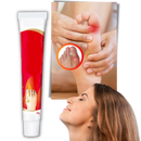 Creme anti-inflamatória Aomeily para oignons do pé, alívio da dor e inflamação em cuidados com os pés.