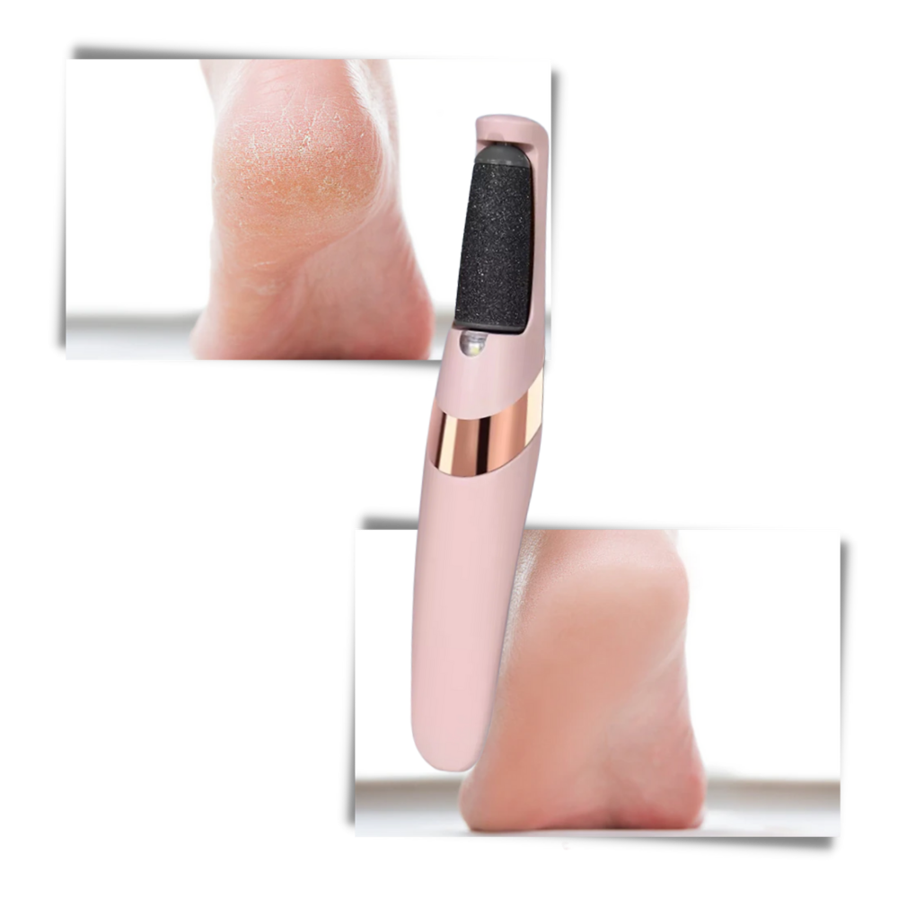 Remover elétrico de calosidades para cuidados dos pés, marca Qhz, dispositivo portátil para eliminar calos e pele grossa.