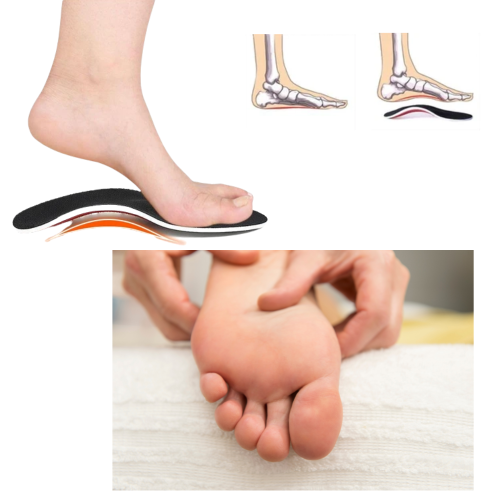 Paire de semelles orthopédiques fermes Walmeck pour pieds plats, soutien de l'arche et soulagement de l'inflammation.