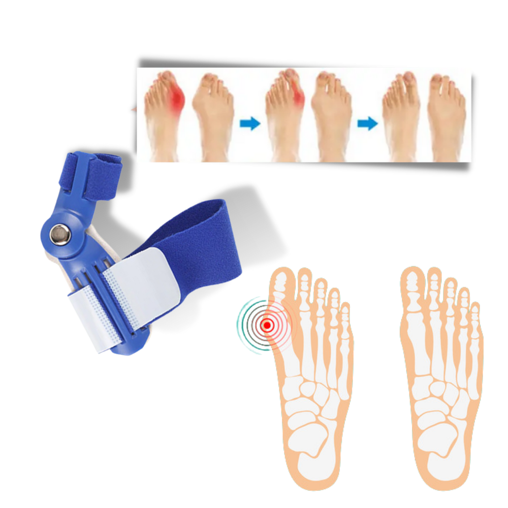 Corrector ortopédico de joanete da Tagco Usa Inc ajudando a aliviar inflamação nos pés, com suporte para o cuidado dos dedos.