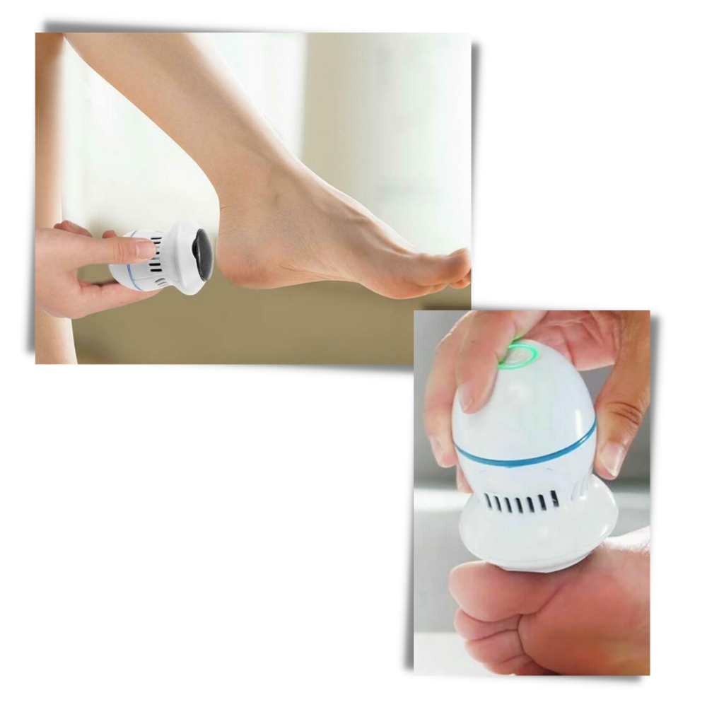 Remover de calos elétrico Eastjing para cuidado dos pés, dispositivo portátil com cabeça de lixa para remoção de calosidade.