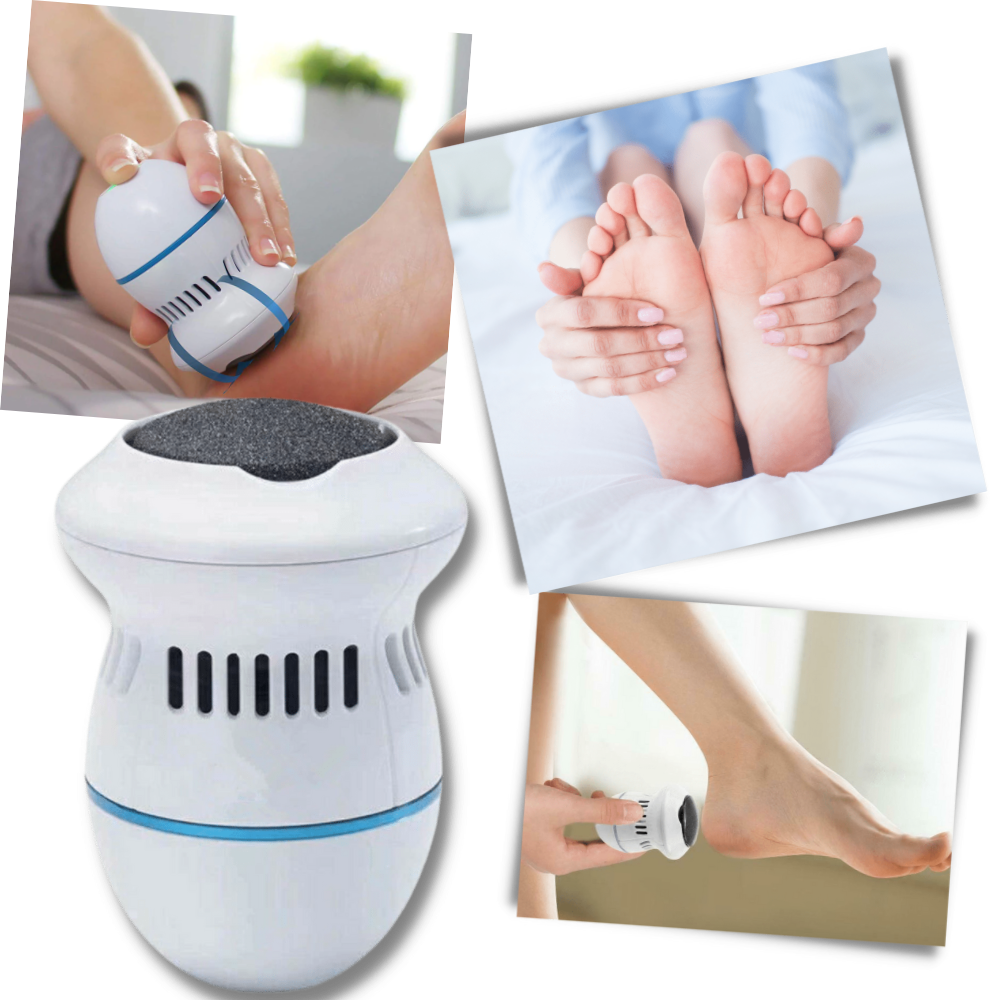 Remover de calos elétrico Eastjing para cuidado dos pés, exibindo o aparelho portátil e superfície de remoção de calos.