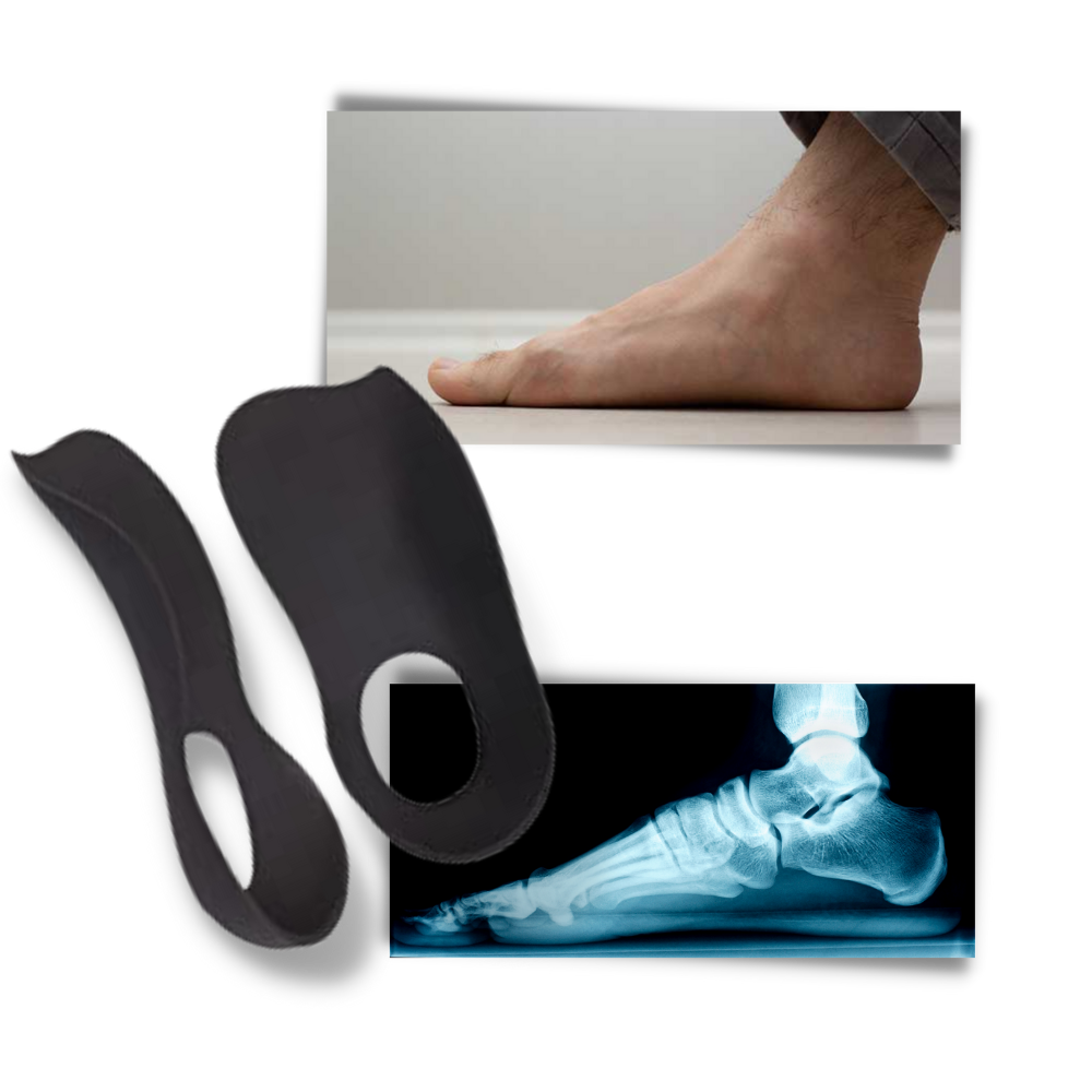 Palmilhas ortopédicas Btguy para pés planos, suporte para o arco e conforto para o cuidado dos pés.