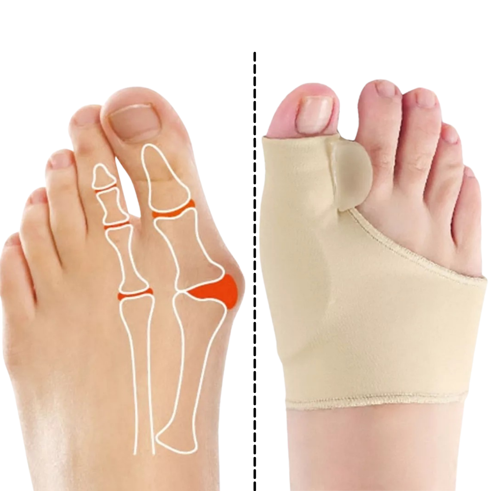 Corrector de joanete de gel Yosoo para cuidados dos pés, alívio e suporte para dedos e articulações.