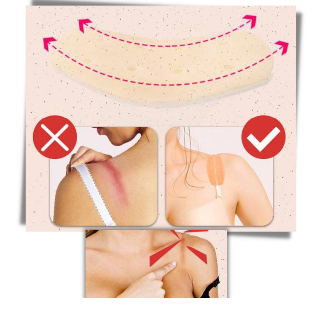 Par de protetores de silicone antiderrapantes para alças de soutien-gorge, proteção antideslizante para roupas íntimas Baosity