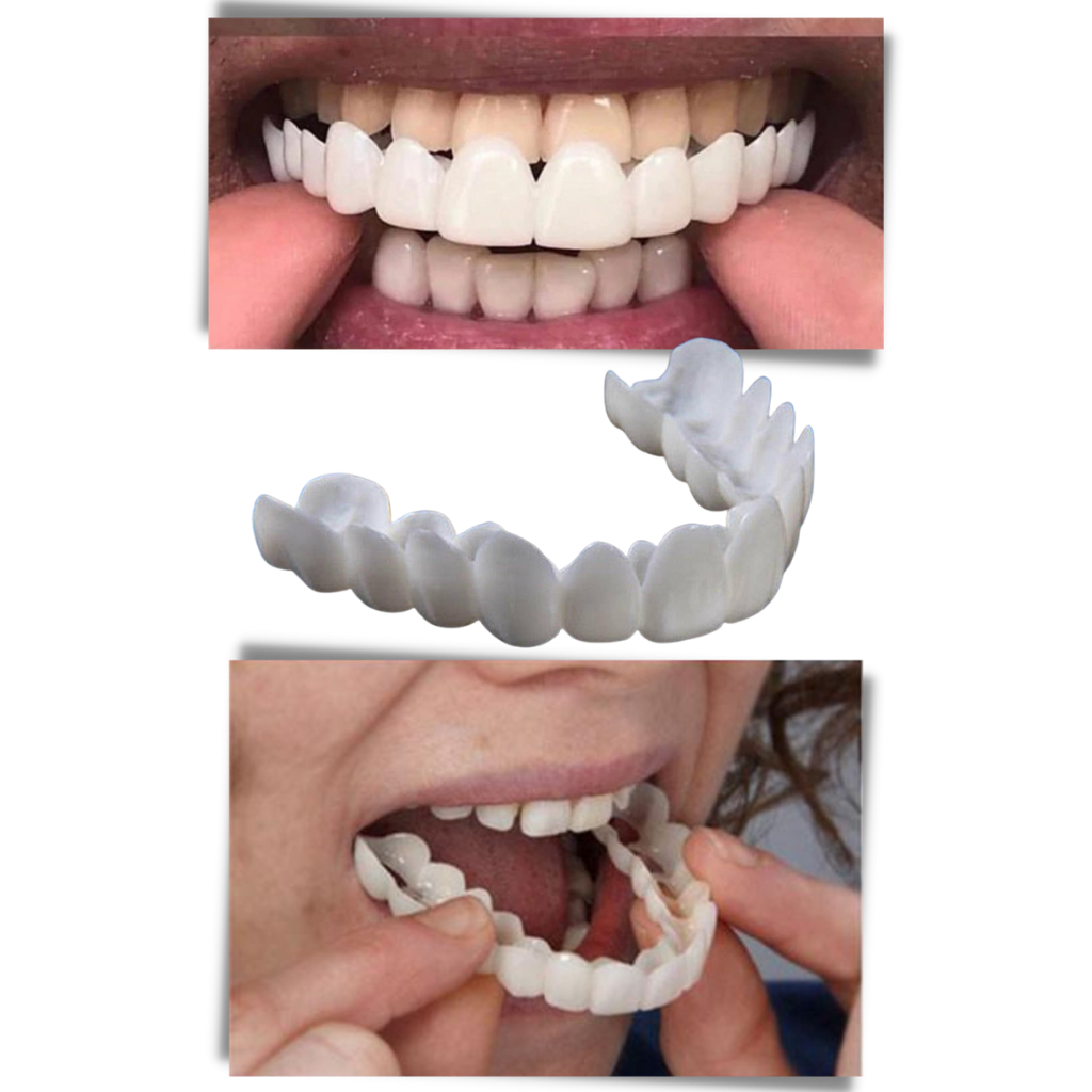 Gouttière de couverture dentaire Pyltt para sorriso perfeito, confortável e sem dor, para cuidados bucais eficazes.