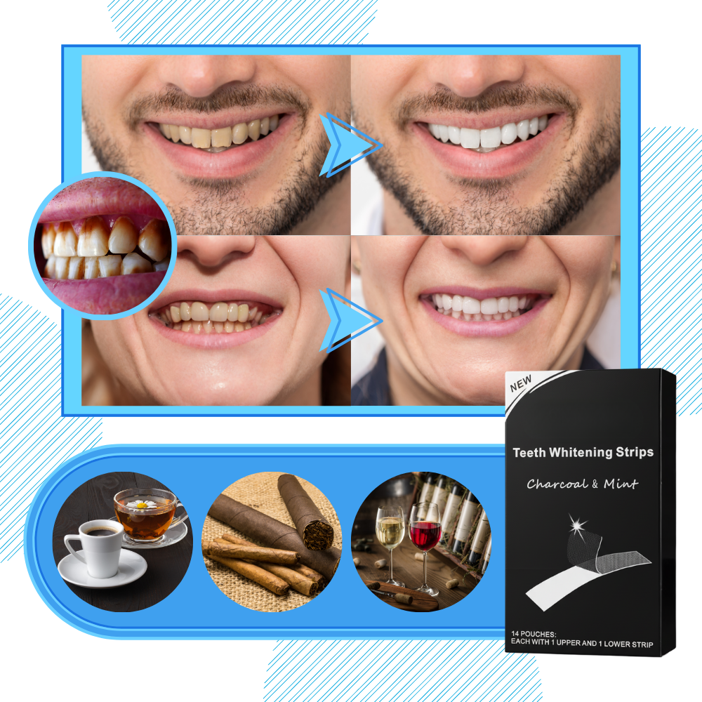 Faixas de branqueamento de dentes com carvão e hortelã, produto de cuidados bucais da marca Ailiu, com embalagem visível.