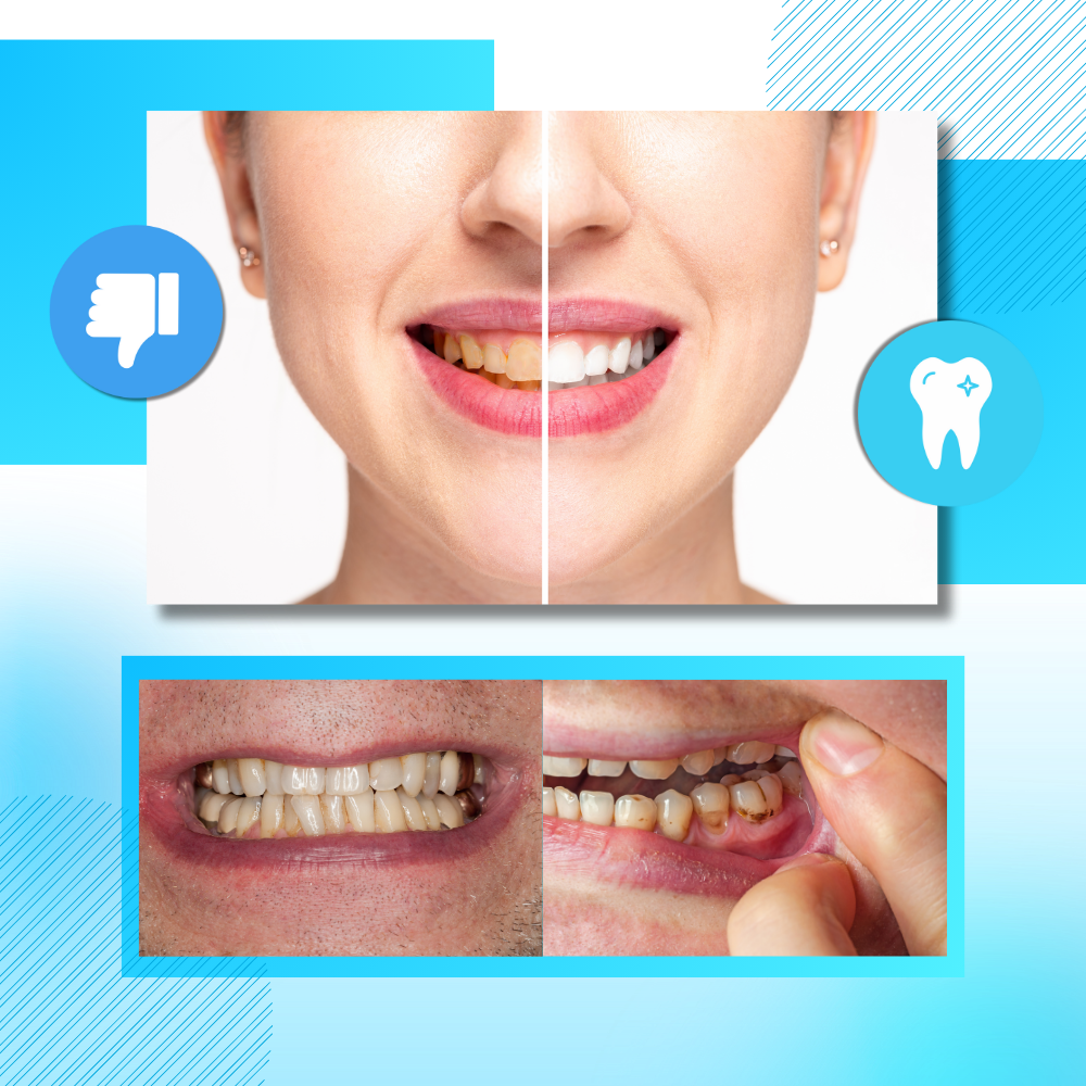 Faixa de branqueamento dental com carvão e hortelã da marca Ailiu, voltada para cuidados bucais.