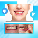 Faixa de branqueamento dental com carvão e hortelã da marca Ailiu, voltada para cuidados bucais.