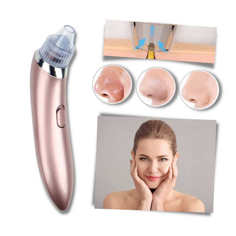 Aspirador de pontos negros da Akloker, dispositivo facial de limpeza de pele com design rosa e tecnologia de extração de cravos.