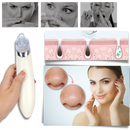 Aspirador de pontos negros da Akloker, dispositivo de limpeza facial com design rosa para remover cravos e impurezas da pele.