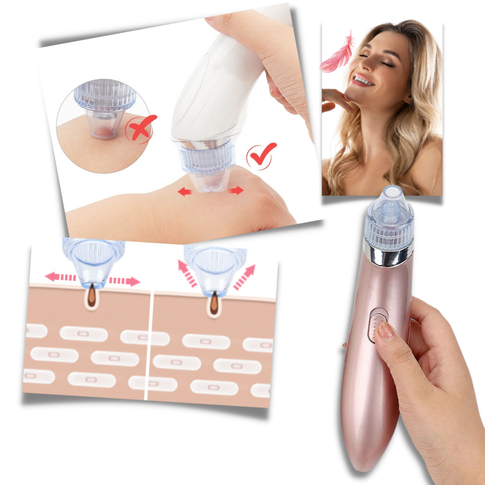 Aspirador de pontos negros facial da Akloker, dispositivo de cosméticos rosa para limpeza da pele do rosto.