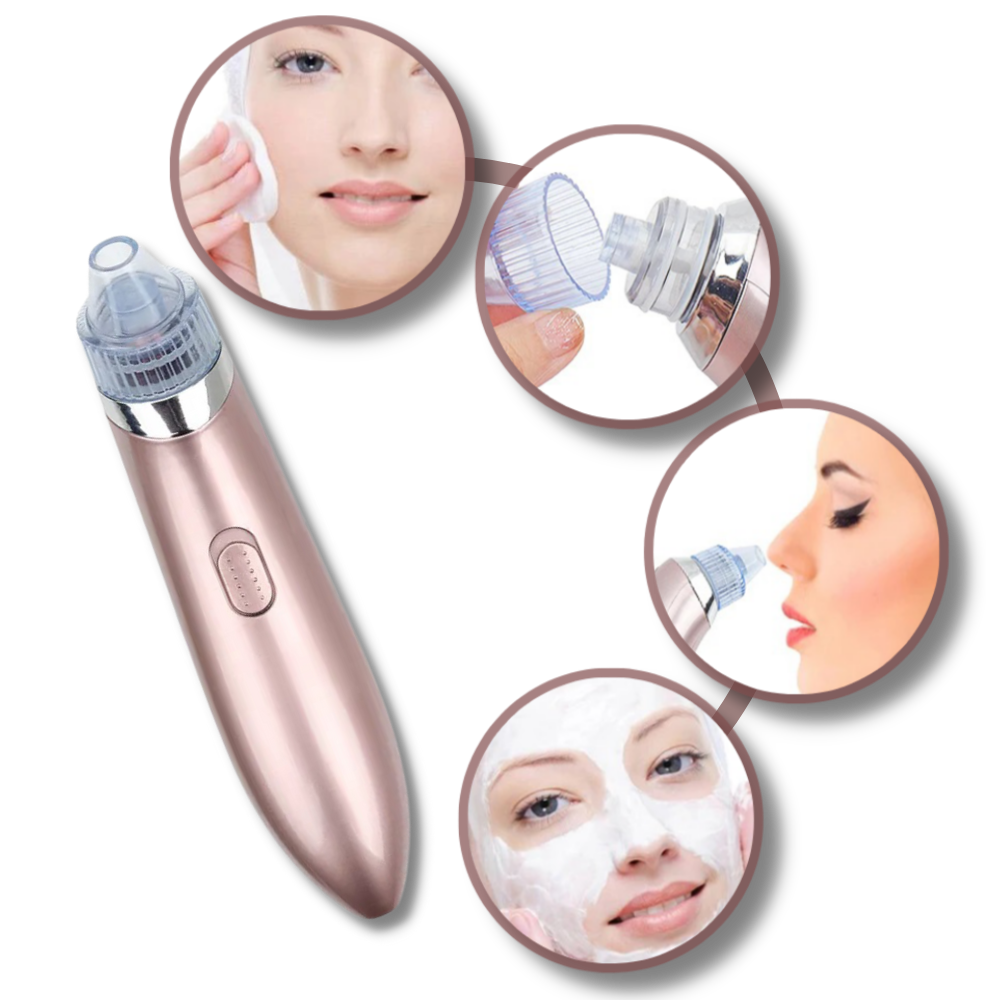 Aspirador de pontos negros Akloker, aparelho de limpeza facial com design em rosa para remover cravos e impurezas.