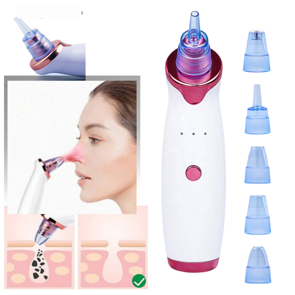 Aspirador extracteur de pontos negros da Asupermall, dispositivo de cosméticos para limpeza facial e remoção de cravos.