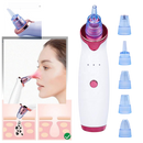 Aspirador extracteur de pontos negros da Asupermall, dispositivo de cosméticos para limpeza facial e remoção de cravos.