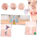 Aspirador extracteur de points negros da Asupermall, produto de cosméticos para limpeza facial.
