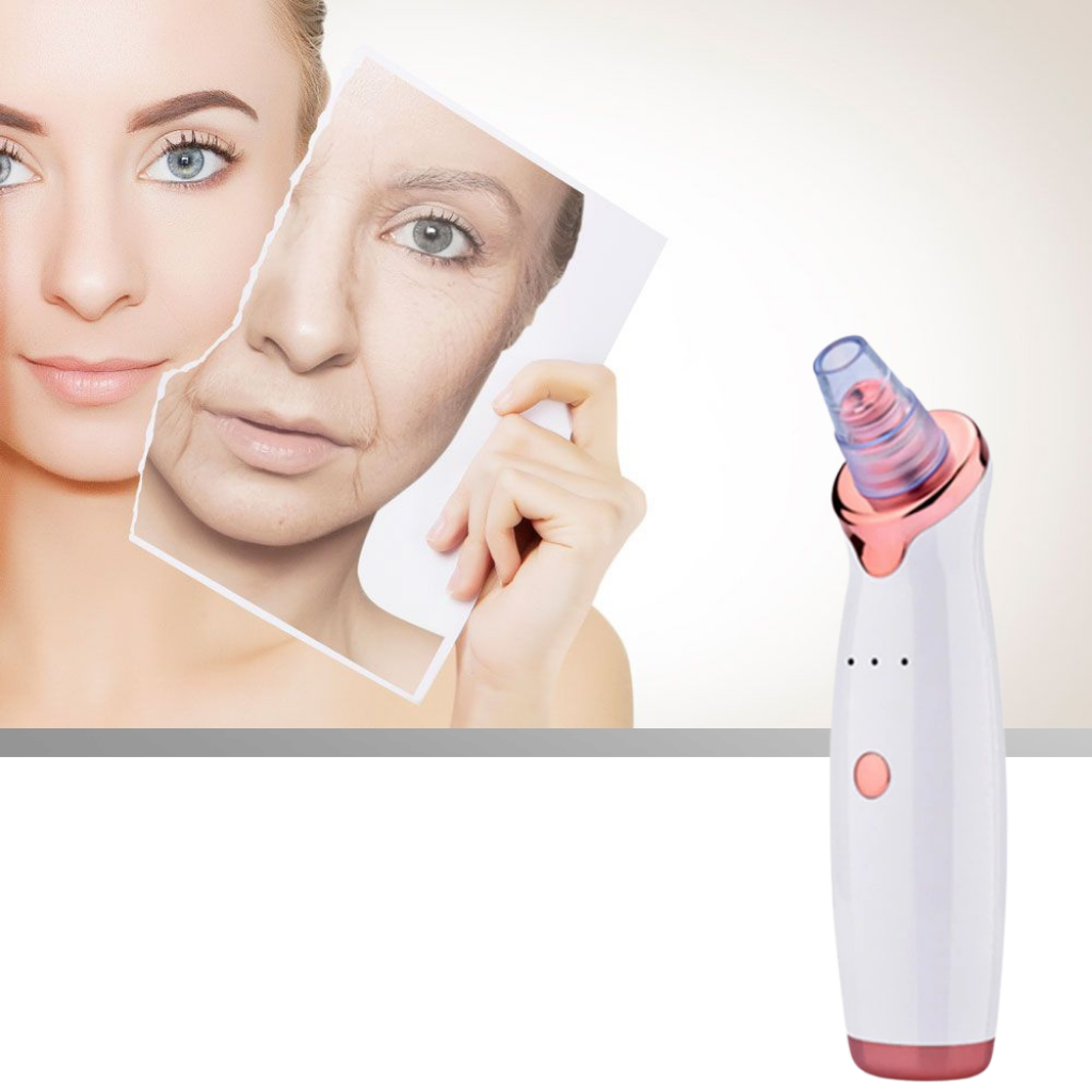 Aspirador extracteur de points negros da Asupermall, pequeno dispositivo de cosméticos para limpeza facial.