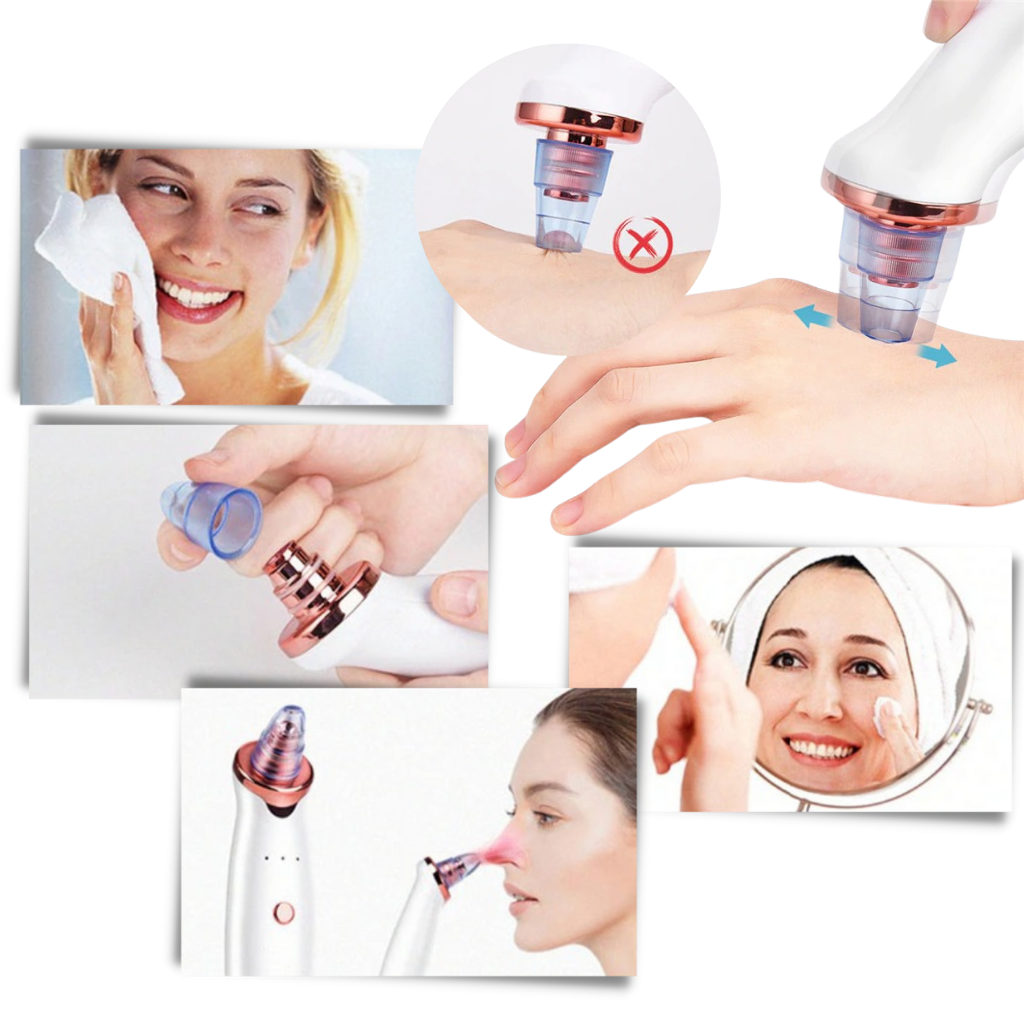 Aspirador extracteur de points negros da Asupermall, dispositivo de cosméticos para limpeza facial, com design compacto.