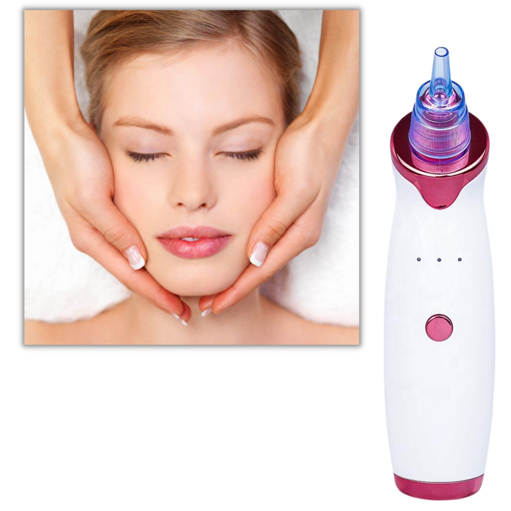 Aspirador extracteur de pontos negros da Asupermall, dispositivo portátil para limpeza facial e remoção de cravos.