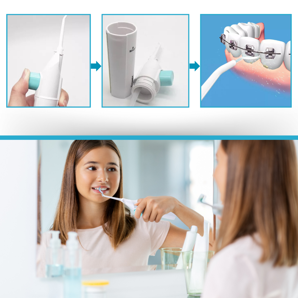 Jet d'eau à air pour les dents de la marque Beautyko U, dispositif de soins buccaux avec embout pour nettoyage dentaire.