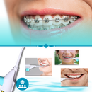 Jet d'eau a air pour les dents de la marque Beautyko U, dispositif de soins buccaux avec embout pour nettoyage dentaire.