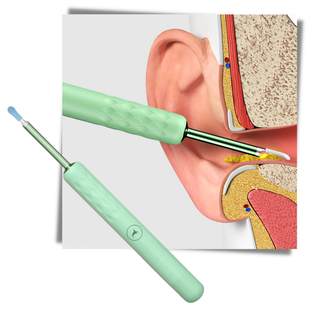 Cure orelha inteligente Bebird, dispositivo de cuidado auricular branco, para limpeza e higiene dos ouvidos.