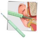 Cure orelha inteligente Bebird, dispositivo de cuidado auricular branco, para limpeza e higiene dos ouvidos.