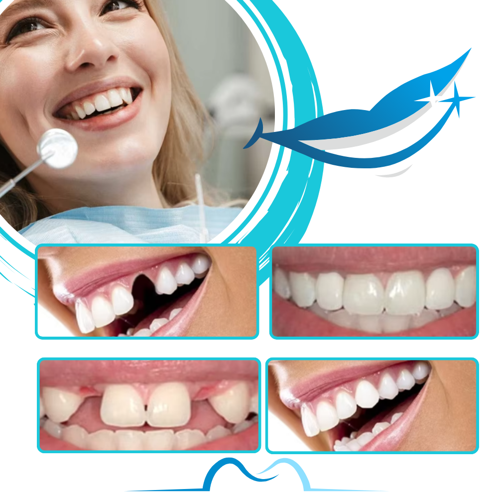 Kit de fausses dents reutilizáveis da Bouanq para cuidados bucais, exibindo dentes artificiais para uso seguro e confortável
