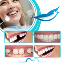Kit de fausses dents reutilizáveis da Bouanq para cuidados bucais, exibindo dentes artificiais para uso seguro e confortável