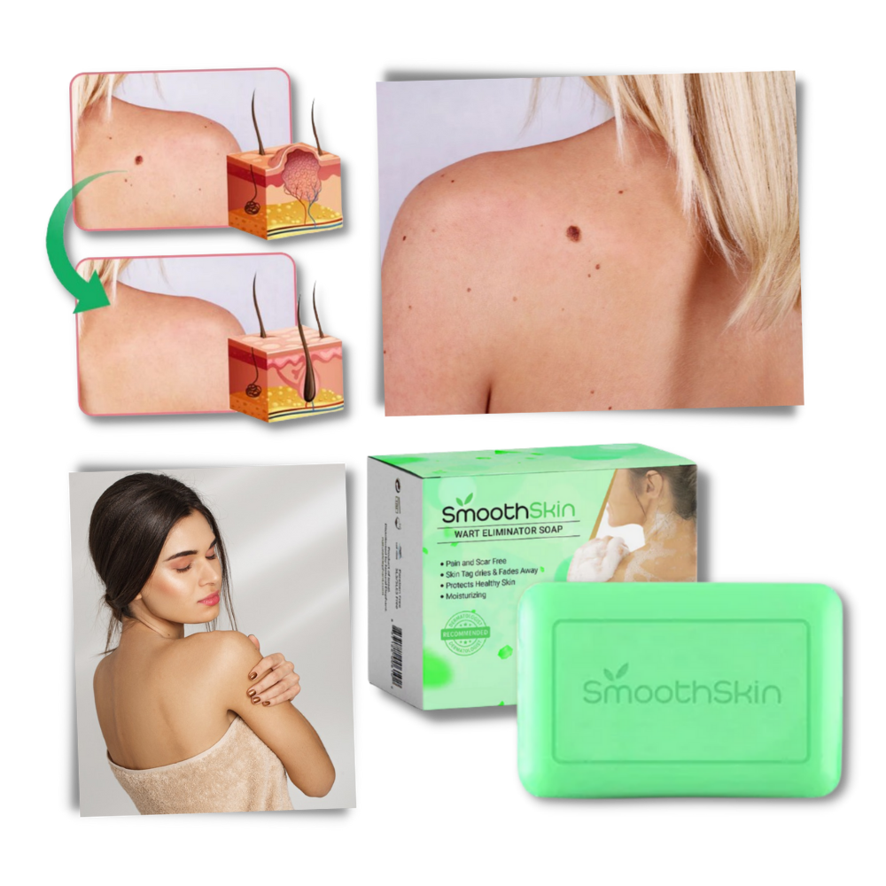 Sabonete exfoliante hidratante da Cn para combater verrugas, com fórmula suave e textura cremosa.