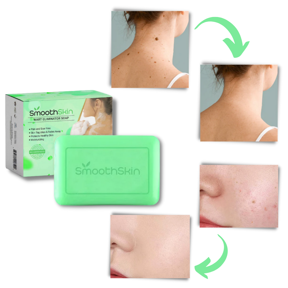 Sabonete esfoliante hidratante da Cn para combater verrugas, com textura cremosa e ingredientes naturais, em embalagem branca