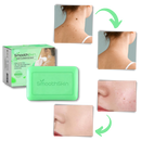 Sabonete esfoliante hidratante da Cn para combater verrugas, com textura cremosa e ingredientes naturais, em embalagem branca