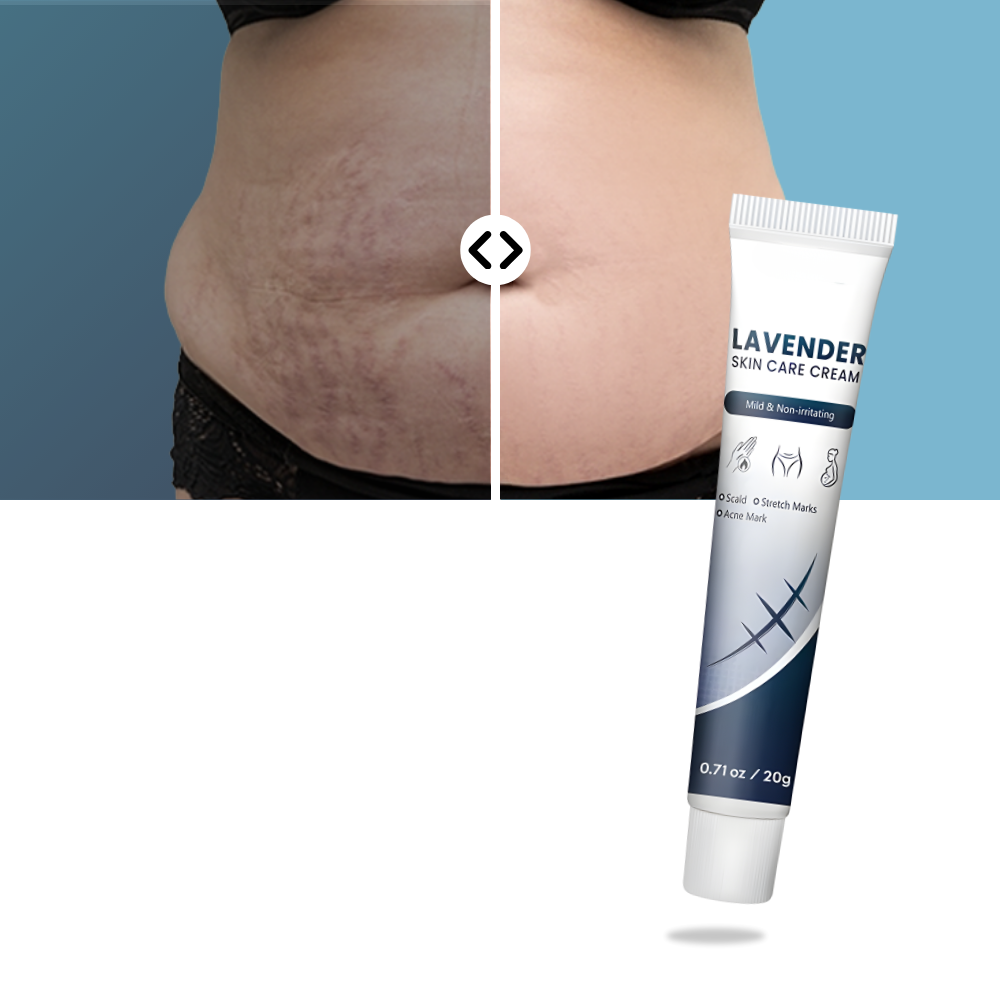 Creme hidratante ao silicone para cicatrizes de gravidez da marca Dimtso, frasco com textura cremosa e embalagem branca.