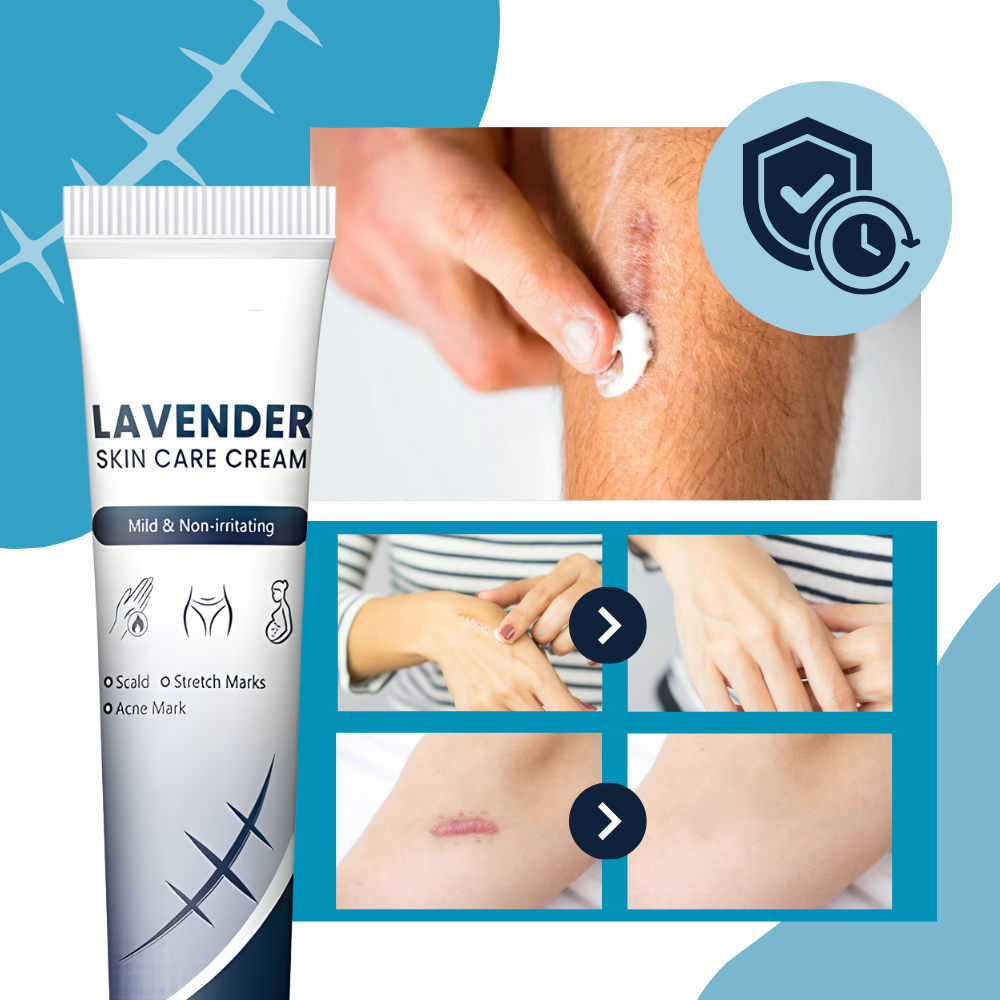 Creme hidratante ao silicone para cicatrizes de gravidez, embalagem branca com tampa azul, produto da marca Dimtso.
