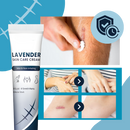 Creme hidratante ao silicone para cicatrizes de gravidez, embalagem branca com tampa azul, produto da marca Dimtso.