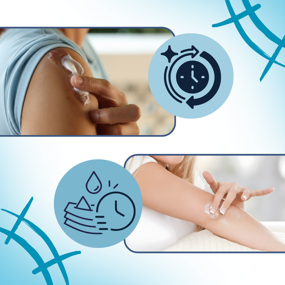 Creme hidratante ao silicone para cicatrizes de gravidez, embalagem com tubo branco e rótulo com detalhes em azul e rosa.