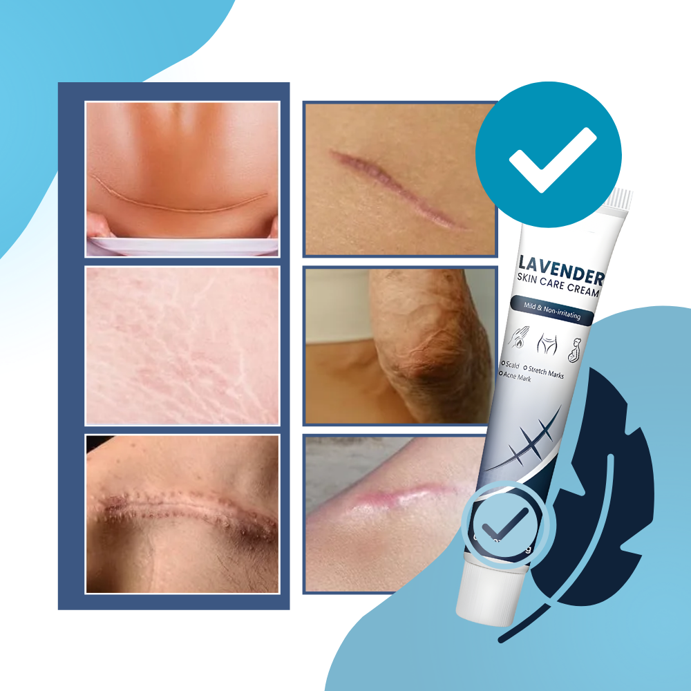 Creme hidratante de silicone para cicatrizes de gravidez da marca Dimtso, frasco branco com embalagem simples.