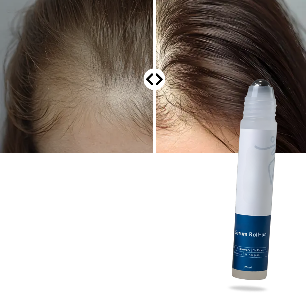 Sérum capilar nutritivo da Eachymn em roll-on, tratamento para cabelos, aplicação fácil e nutritiva para fios saudáveis.