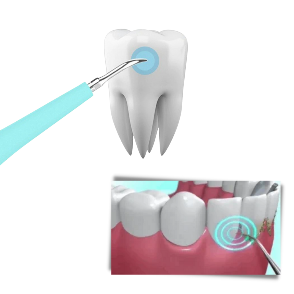 Máquina de cuidados bucais Eccomum para descalcificação dentária, na cor azul, com detalhes visíveis na imagem.