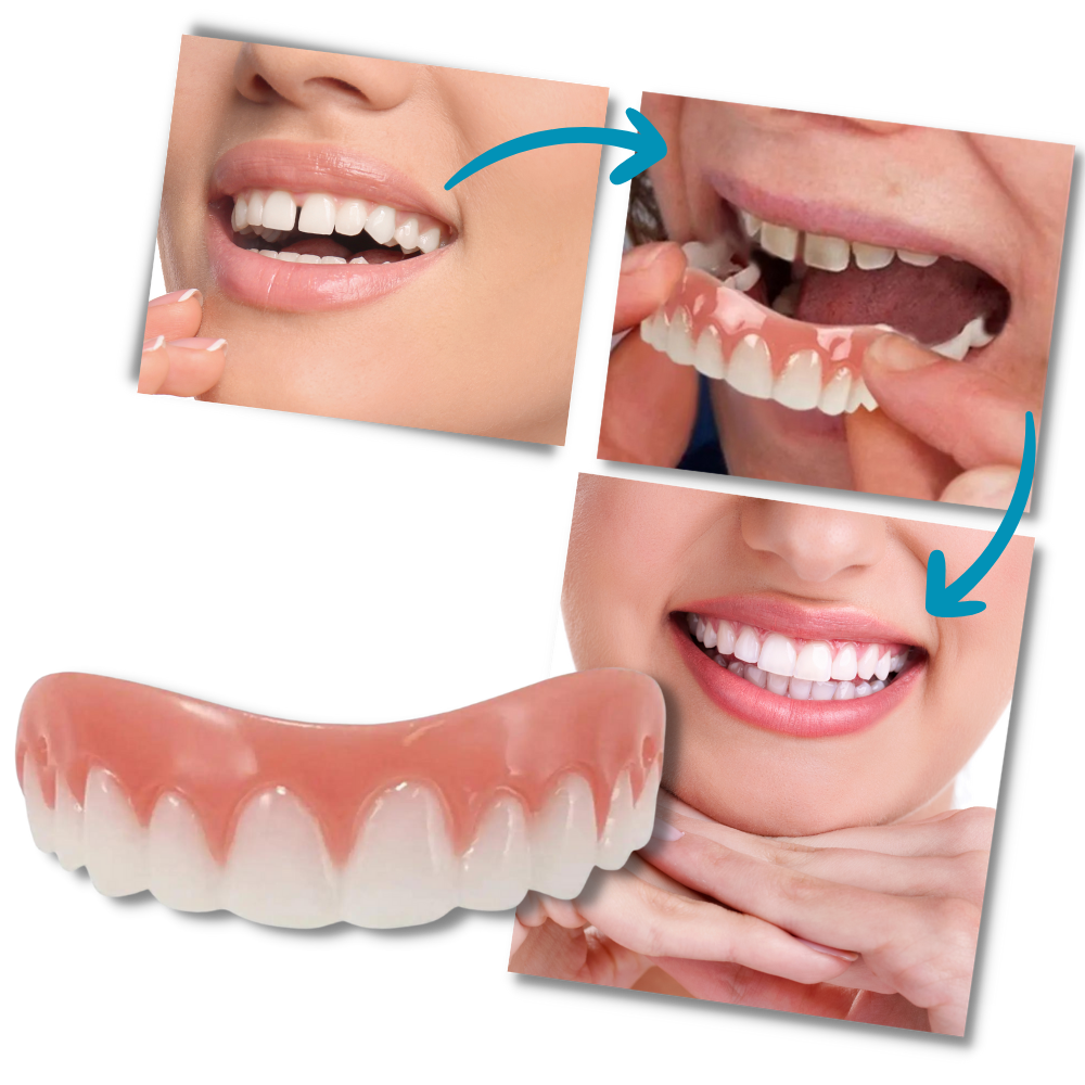Facetas dentárias à clipar da marca Everso, produto de cuidados bucais, visível na imagem.