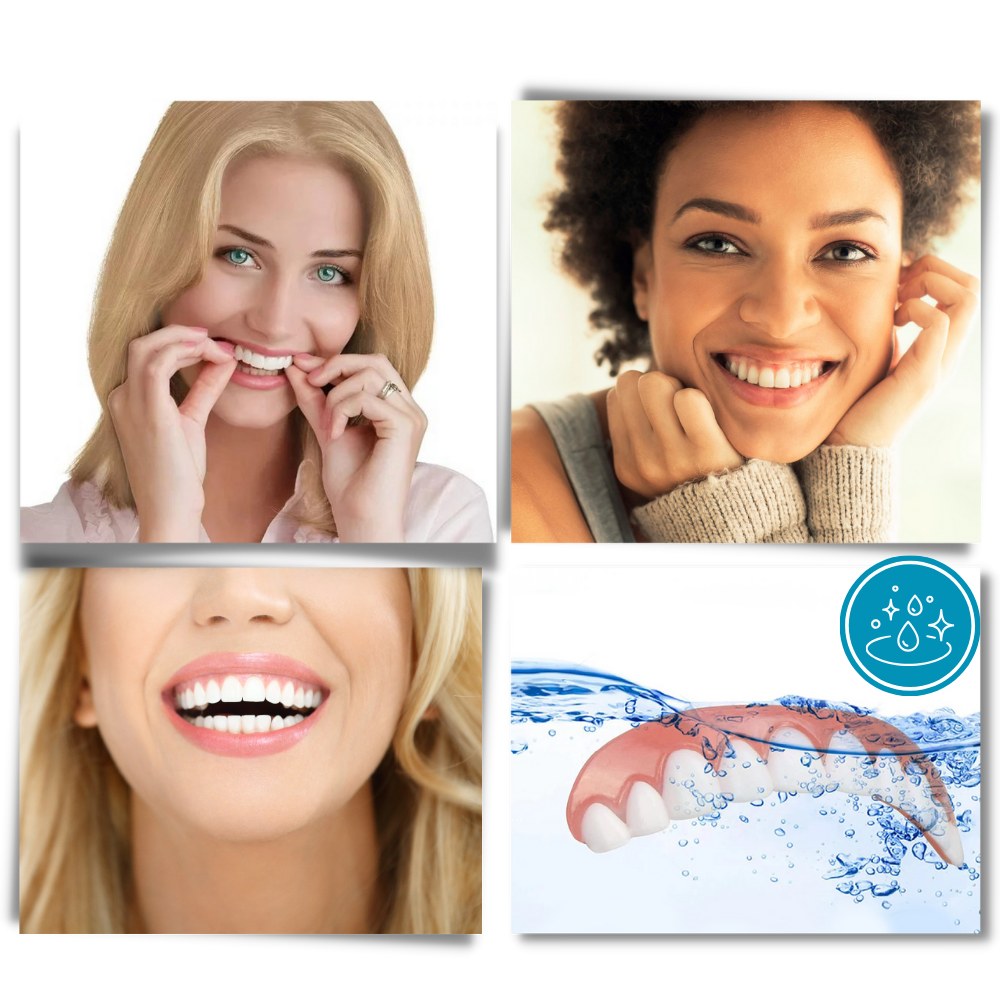 Facettes dentárias à clipar da marca Everso, acessório de cuidados bucais para melhorar a estética dental.
