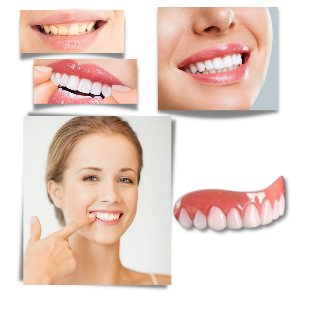 Facettes dentaires à clipser Everso, soin buccal pour améliorer l'apparence des dents, image montrant la fixation et la texture.