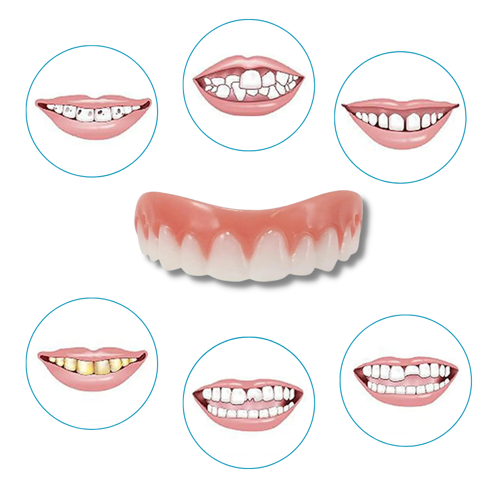 Facettes dentaires à clipser Everso, soin buccal, montradas na imagem com detalhes de encaixe e acabamento natural.