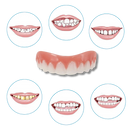 Facettes dentaires à clipser Everso, soin buccal, montradas na imagem com detalhes de encaixe e acabamento natural.