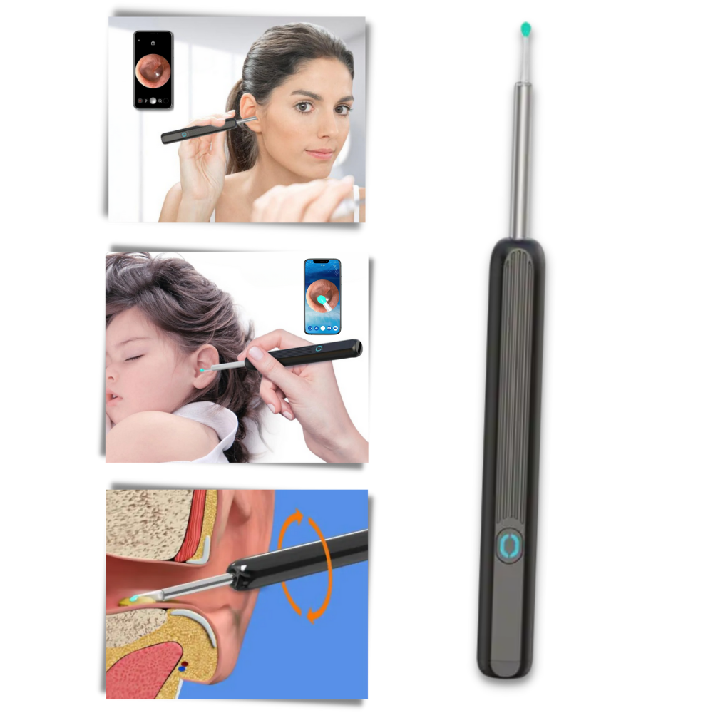 Câmera de limpeza de ouvido Foxnovo para remoção de cera, dispositivo de cuidado auditivo com câmera integrada.