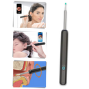 Câmera de limpeza de ouvido Foxnovo para remoção de cera, dispositivo de cuidado auditivo com câmera integrada.